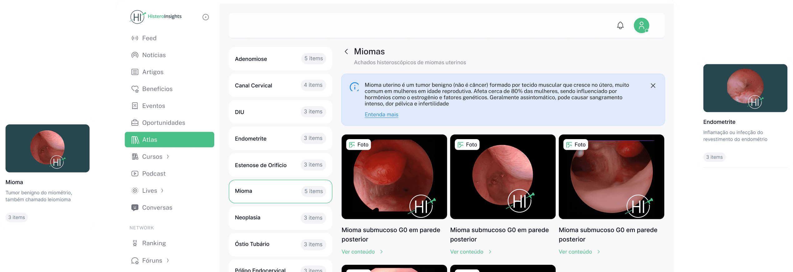 Plataforma Histero Insights — atlas de histeroscopia